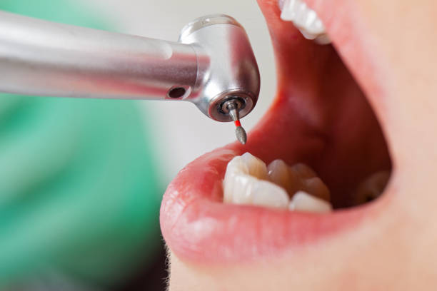 Best Tooth Infection Emergency Dentist  in Green Tree, PA